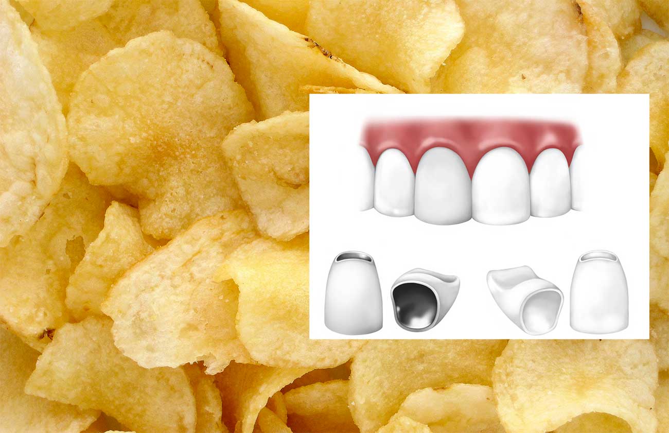 potato chips dental Viral