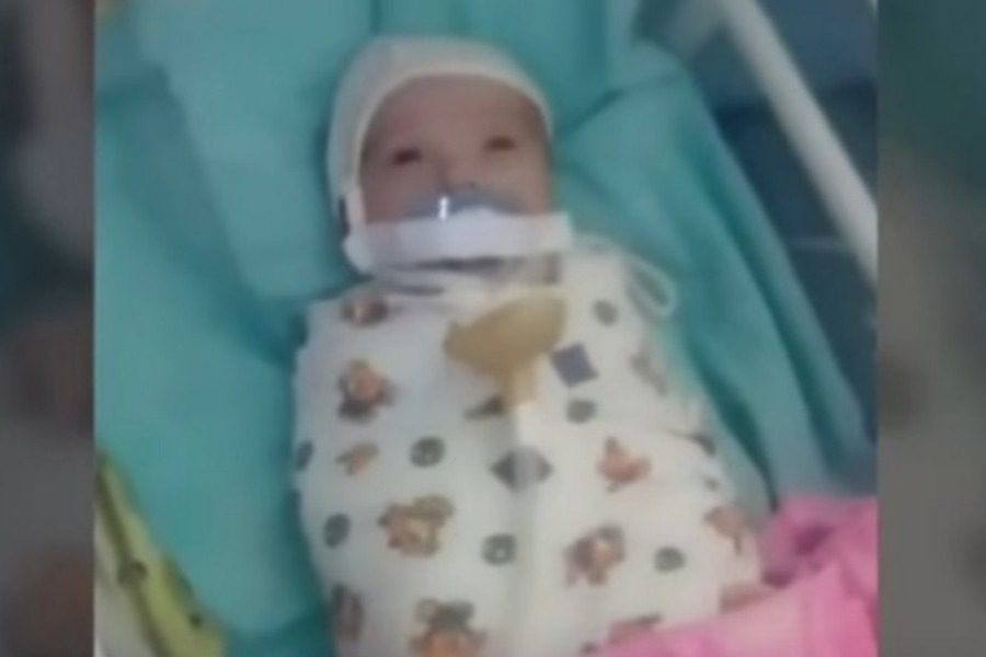 Unthinkable: They stuck a pacifier tape in the baby's mouth