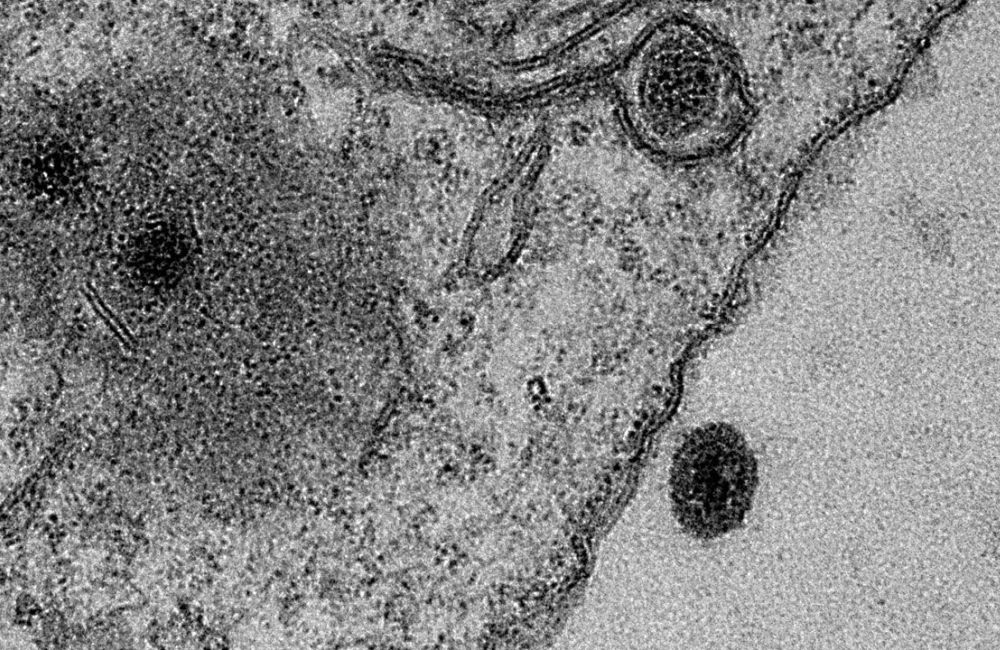 Yaravirus νέος ιός