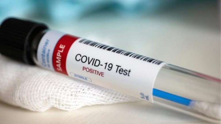 covid 19 7 Coronavirus, increase of cases, TEST