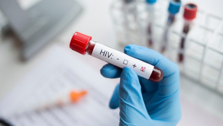 st hiv HIV, Θεραπεία