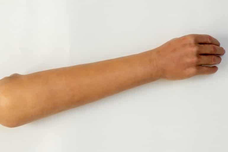 silicon arm hand xeri silikonis vaccine